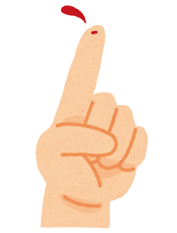 Iphoneの画面割れ 症状が出ていない場合でも放置は危険です スマホスピタル